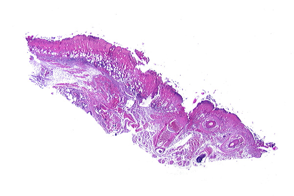 Ectromelia virus; Mousepox virus; Poxvirus muris