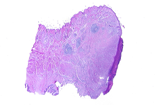Canine eosinophilic