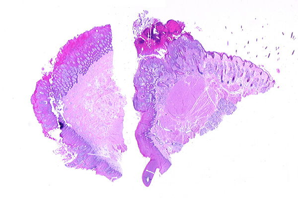 Read-Only Case Details Reviewed: Oct 2010