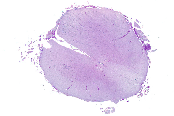 read only case details reviewed apr 2008 equine protozoal myeloencephalitis