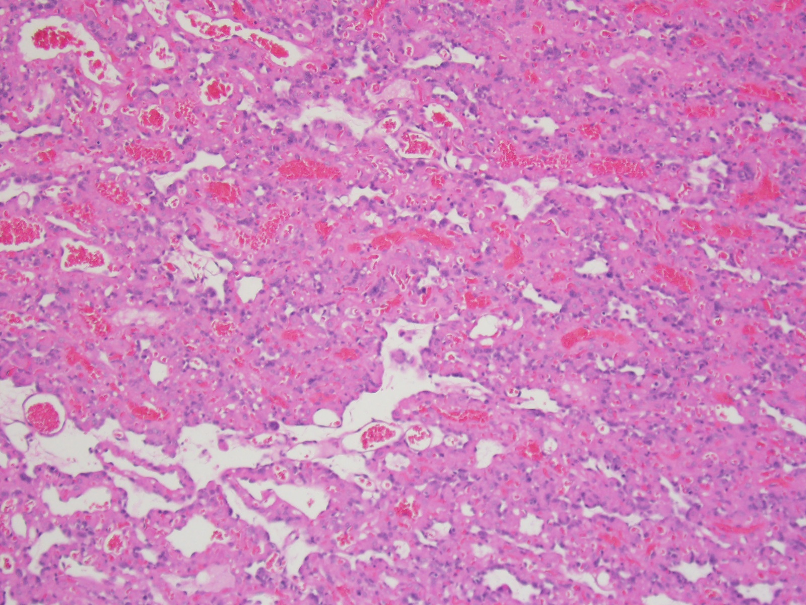 RM01d n3 10x jpg