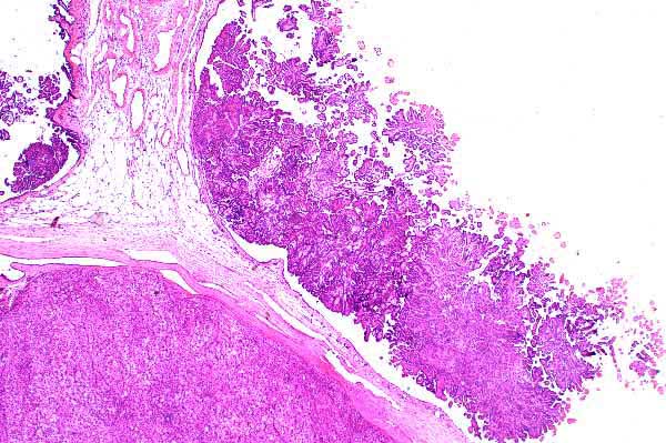 Arborizing Polyps rn04bb02.jpg