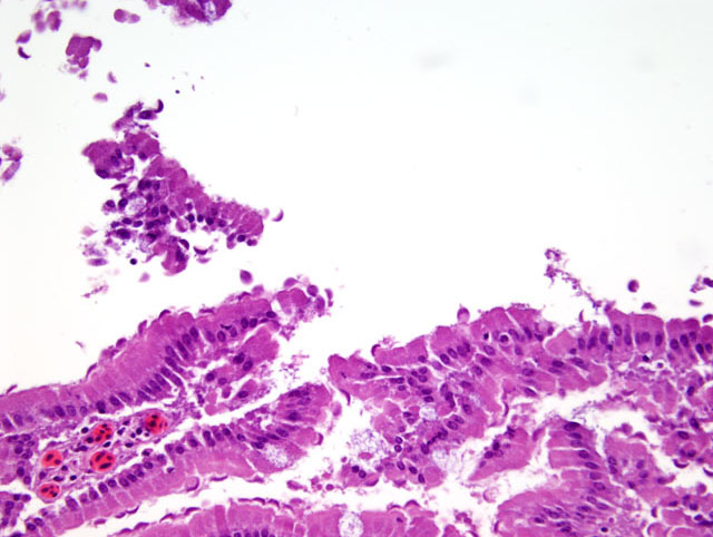 giardia colon histology ektoparaziták és endoparaziták