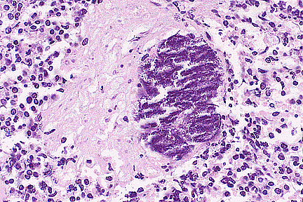 Histopathological lesions in reproductive organs, distal
