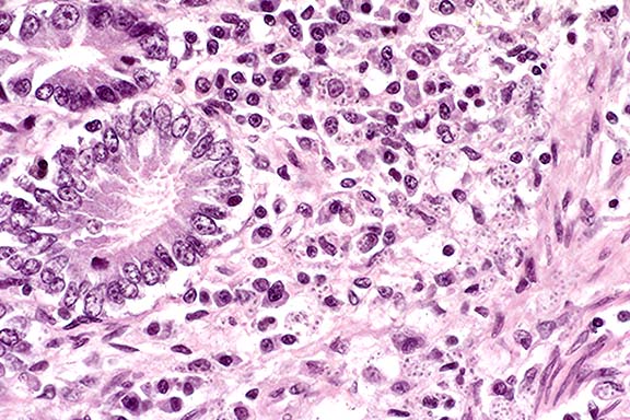 Color Atlas and Text of Surgical Pathology of the Dog and Cat Vol 1 Dermatopathology and Skin Tumors